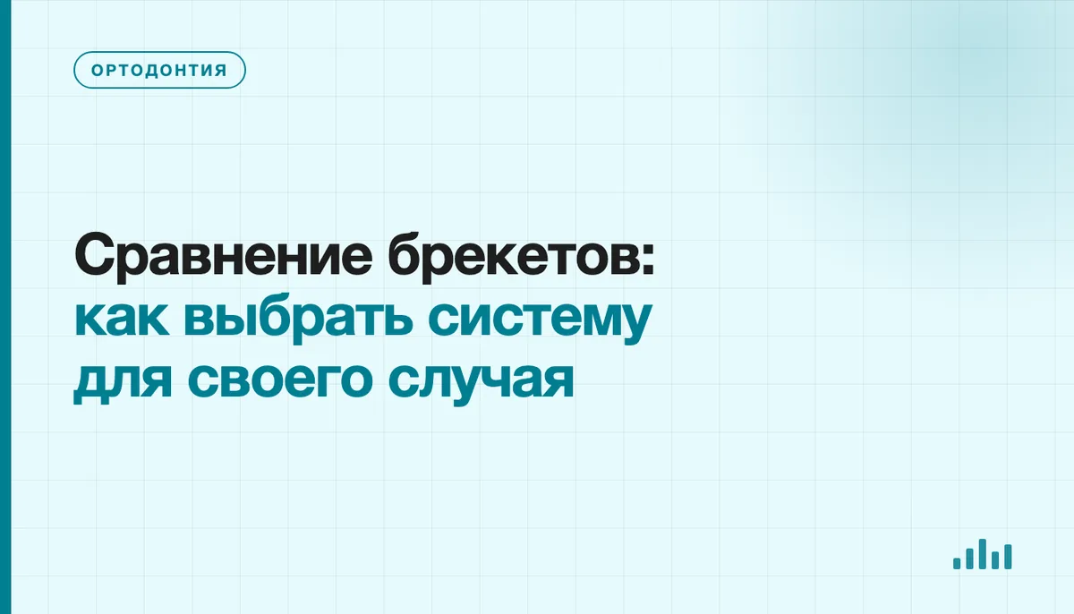 Образцы брекетов из разных материалов для сравнения