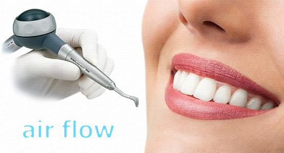 Air Flow - лучшая методика чистки зубов